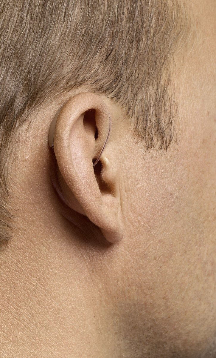 Hinter-dem-Ohr-Hörgerätetypen